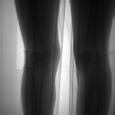WR-3D lower-limb alignment image under weight-bearing conditions